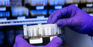 вирус папилломы человека по омс