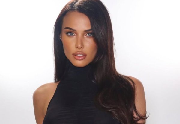 Анастасия Решетова рассказала, что пожалела о своей пластической операции