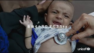 【ユニセフ公共CM】つなぐよ子に（サナド・栄養不良編）