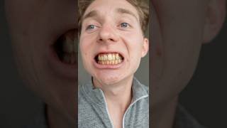 I Fixed My Rotting Teeth