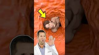 ER Doctor REACTS to Swallowed by a Sperm Whale (Zack D. Films)