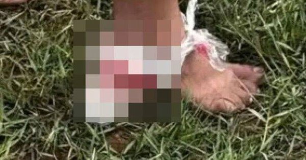 Bloody piranha attack injures 10 swimmers at Brazil’s Paraguacu River