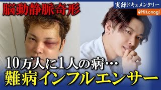 【難病】10万人1人の病にかかり即入院に。難病インフルエンサー間瀬翔太の身に起きたことは⁉︎