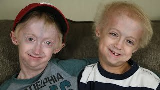 Brothers with Progeria (Nathan and Bennett)
