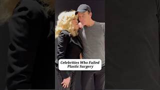 Celebrities Who Failed Plastic Surgery, #celebritynews #celebrity #celebritygossip #shorts #foryou