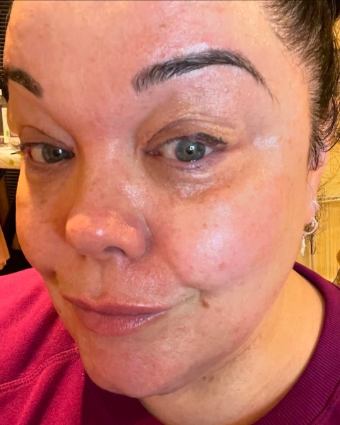 Looking after my skin.ABSOLUTELY NO FILTER OR LIGHTING HE...