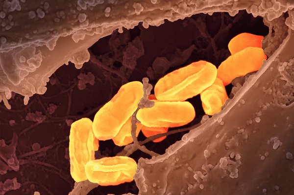 Dangerous disease ’as old as the plague’ hits record high in California