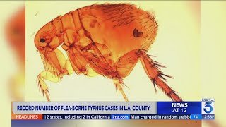 Record 220 flea-borne typhus cases reported in L.A. County