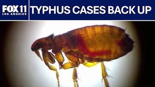 Typhus, a dangerous disease, making a comeback: FOX 11 LA
