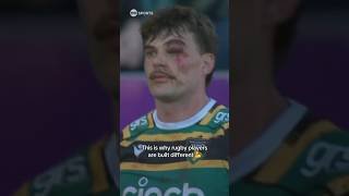 George Furbank is tough 😤