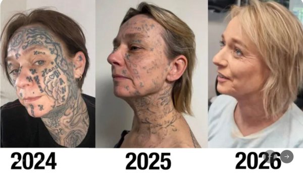 Violences conjugales : aux Pays-Bas, une femme se fait tatouer 250 fois le prénom de son ex-conjoint sur le visage et le corps