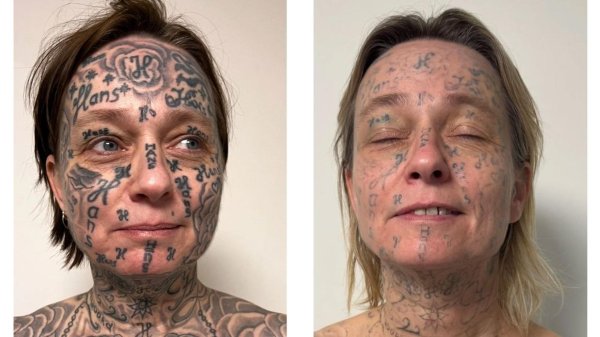 Tatouée de force sur 90 % du corps, elle devient le visage d’une campagne de détatouage