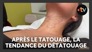 Après la folie du tatouage, la tendance du détatouage fait son apparition