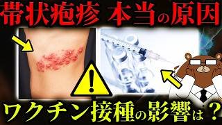 【超意外】絶対に知らないと後悔する「急増」している帯状疱疹の本当の原因。ワクチン接種の影響は？なぜ増加しているのか。なる人とならない人の違い。ストレスとの関係性は？予防法はあるのか？医師が完全解説。