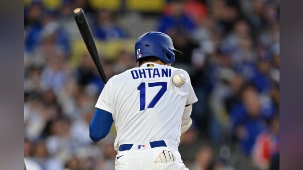 大谷翔平１５１キロが右肩直撃し顔ゆがめ絶叫、湿布貼り球場後に…監督は次回登板に言及